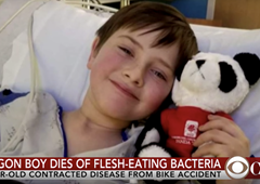 Tragédie v americkém Oregonu: malý chlapec zemřel po pádu na infekci